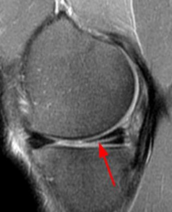 London, Business, Where Can I Get An MRI Of The Knee Joint Quickly?