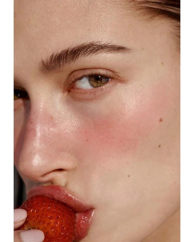 Toronto, Beautician, Rosacea Laser Treatment Toronto | Tight Clinic | Book Today