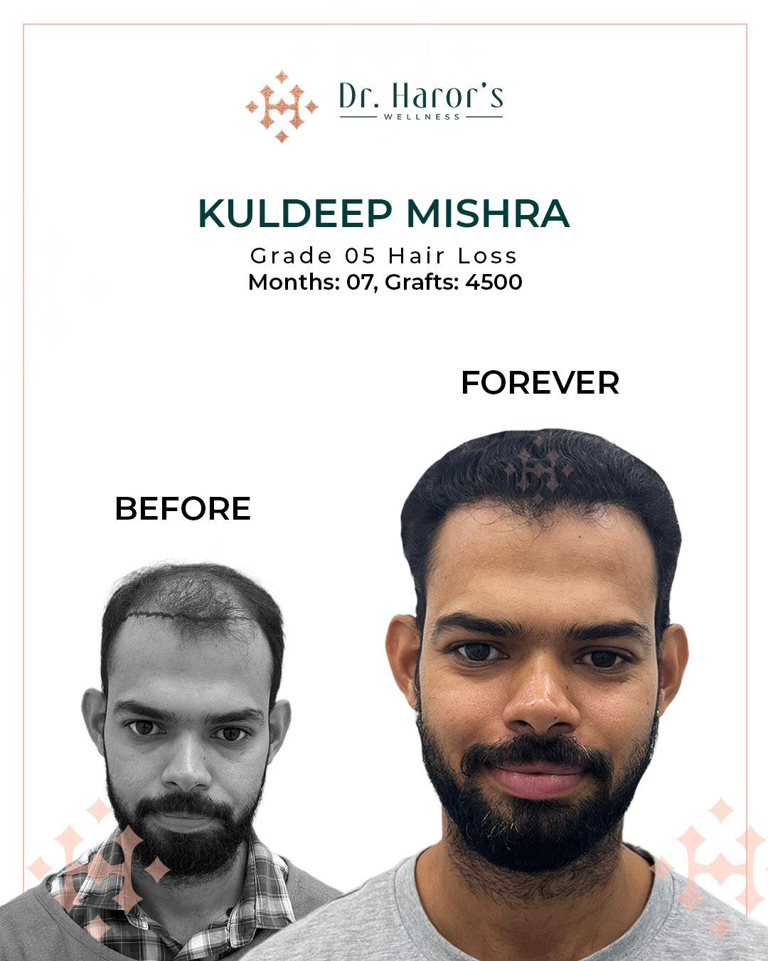 New Delhi, Health, See It To Believe It &mdash; Transformations That Wow!