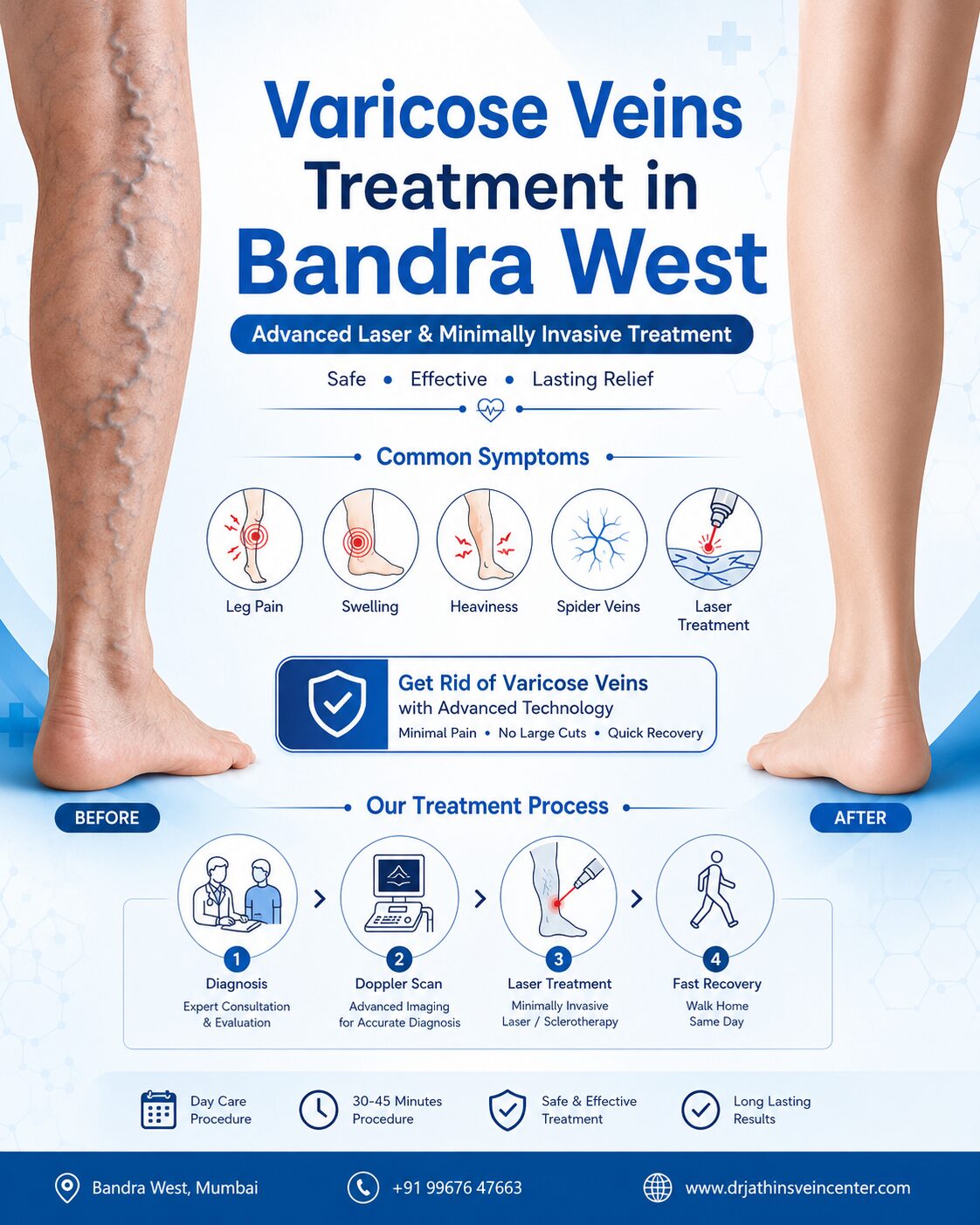 Mumbai, Health, Experience Advanced Vein Care In Bandra West