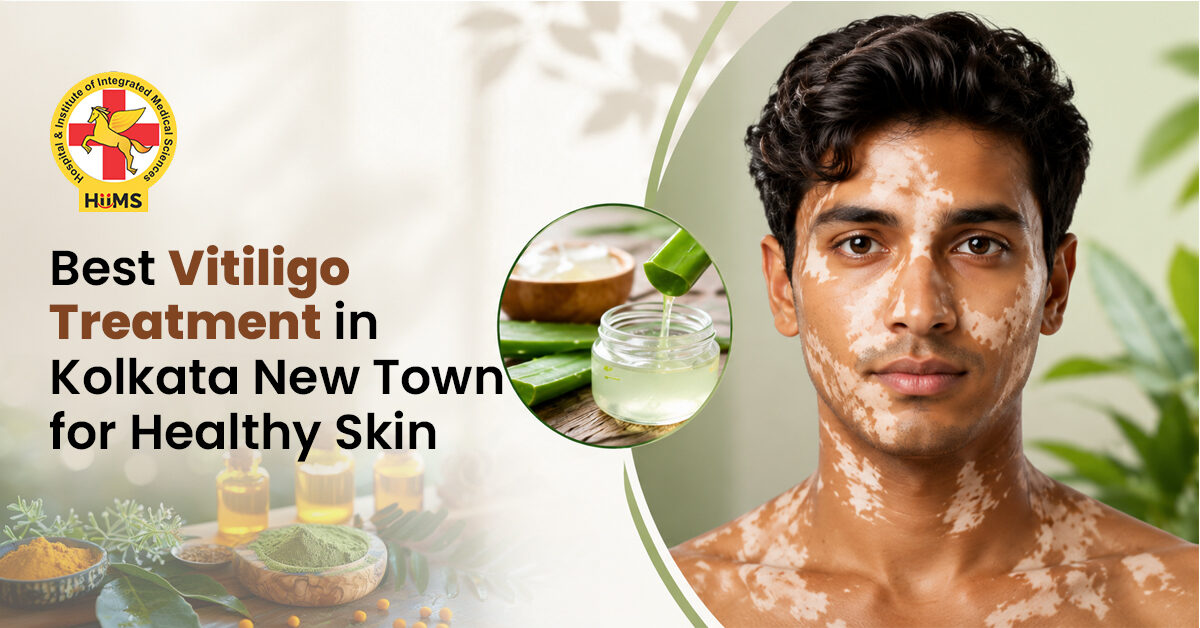 Kolkata, Health, Searching For Vitiligo Treatment In Kolkata New Town?