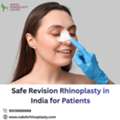 Safe Revision Rhinoplasty In India For Patients