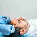 Best Chemical Peel Treatment In Bengaluru