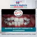 Affordable Guided Biofilm Therapy Cost In Hyderabad | Advanced Dental Cleaning Solutions