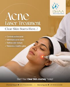 Hyderabad, Health, Acne Laser Treatment In Chandanagar