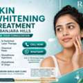 INR 4999, Skin Whitening Treatment In Banjara Hills, Hyderabad