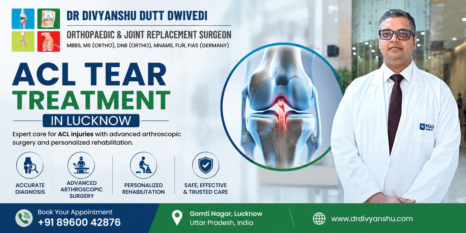 Lucknow, Medical, Best ACL Tear Treatment In Lucknow &ndash; Expert Care For Knee Ligament Injuries