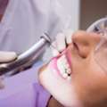 Cosmetic Dental Clinic Brampton | Expert Smile Solutions