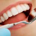 Affordable Wisdom Teeth Infection Removal Treatment