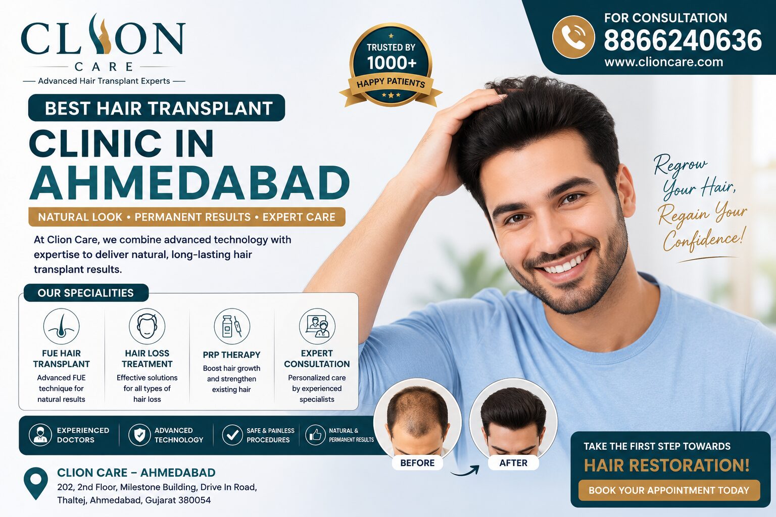 Ahmedabad, Health, Get Hair Transplant In Gujarat In Ahmedabad