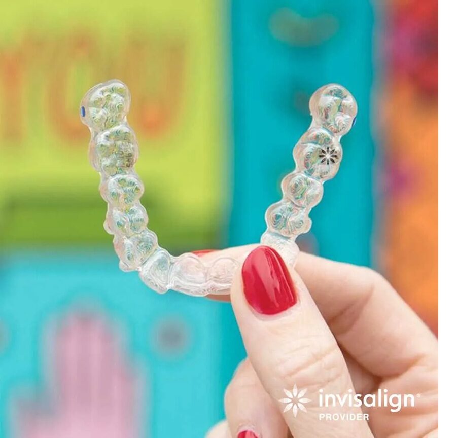 San Diego, Health, Invisalign Before And After
