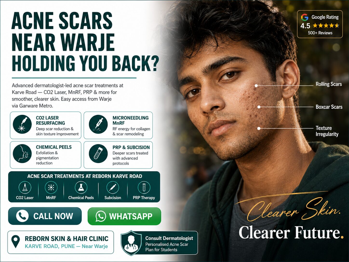 Pune, Health, Acne Scar Treatment Near Warje | Campus Ready Skin Before Your Next Semester