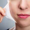 Chemical Peel Treatment In Highbury London By Experts