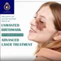 Advanced Laser Birthmark Removal In Thane | DNA Royal Skin Clinic.