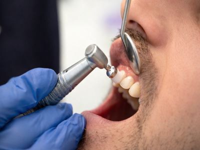Kolkata, General, Best Dental Clinic Newtown &ndash; AB Dentologic