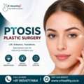Transform Your Look With Expert Ptosis Plastic Surgery