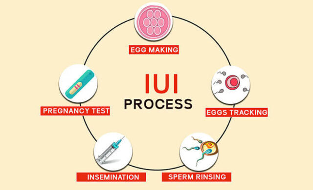 New Delhi, Health, IUI Treatment In Delhi - Dr Rhythm Gupta