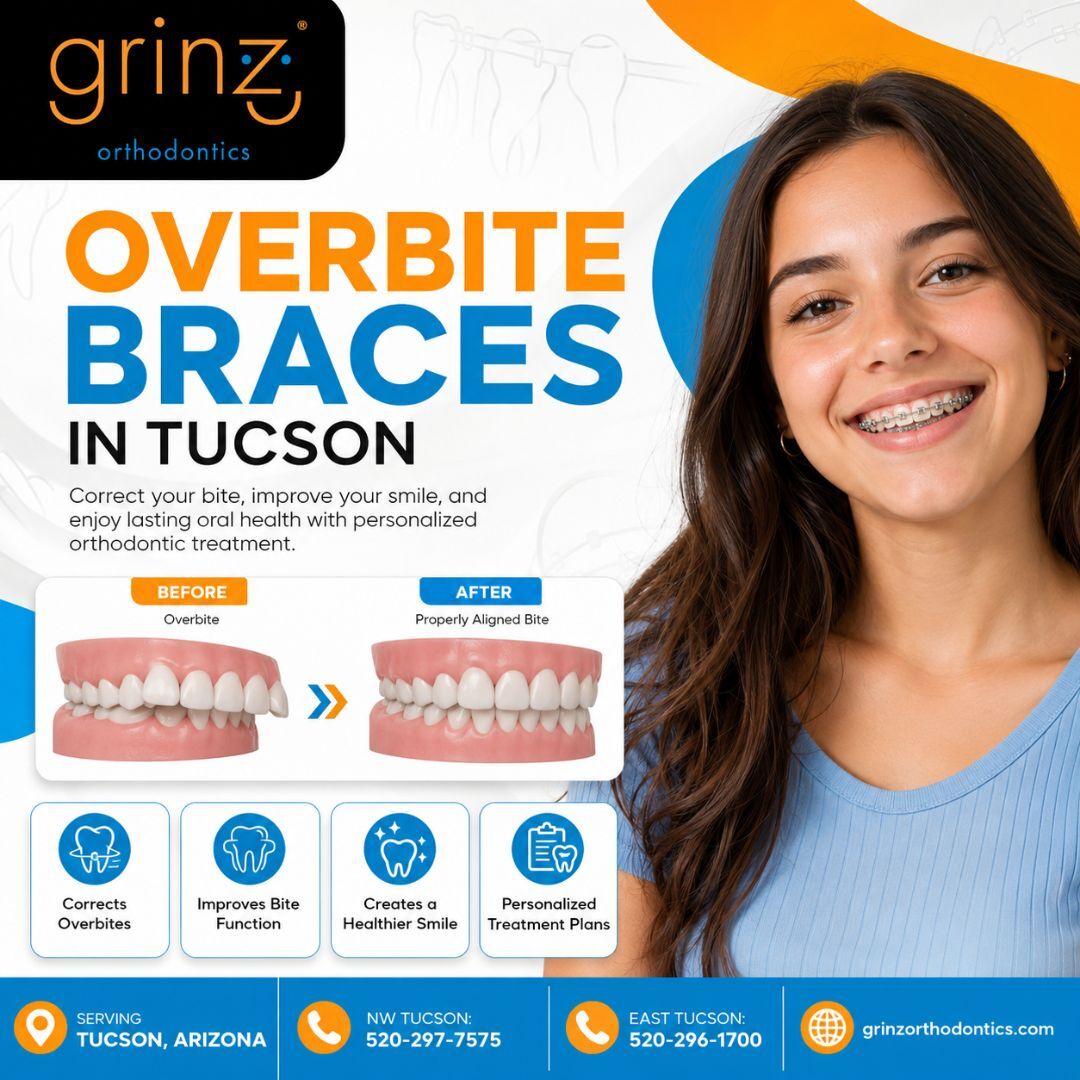 New York, Dental, Overbite Braces In Tucson