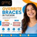 Overbite Braces In Tucson