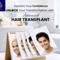 DNA Royal: No.1 Hair Transplant Clinic In Thane For Natural Results.