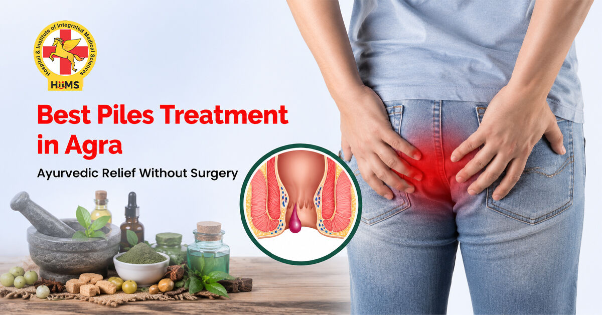 Mumbai, Health, Best Piles Treatment In Agra | Ayurvedic Relief Without Surgery