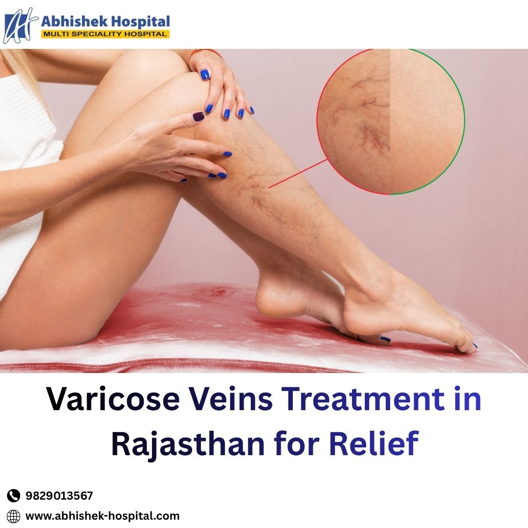 Jaipur, Health, Varicose Veins Treatment In Rajasthan For Relief
