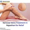 Varicose Veins Treatment In Rajasthan For Relief