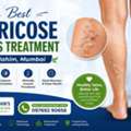 Advanced Care For Healthy Veins