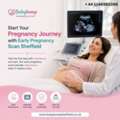 Start Your Pregnancy Journey With Early Pregnancy Scan Sheffield