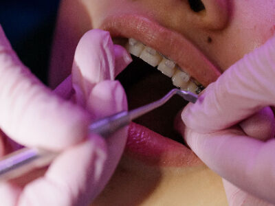 Kolkata, General, AB Dentologic &ndash; Top Dental Clinic Newtown For Quality Dental Care