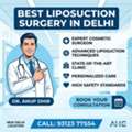 Best Liposuction Surgery In Delhi | Dr. Anup Dhir