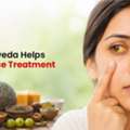How Ayurveda Helps In Jaundice Treatment In Sonipat