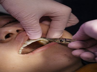 Kolkata, General, Top-Rated Dental Clinic Newtown &ndash; AB Dentologic