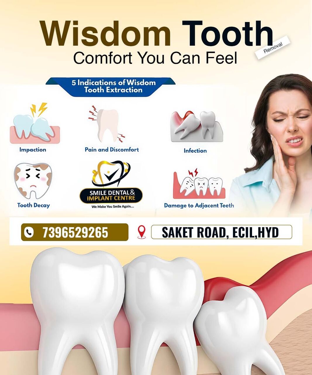 Hyderabad, Dental, Relieve Wisdom Tooth Pain Safely In AS Rao Nagar