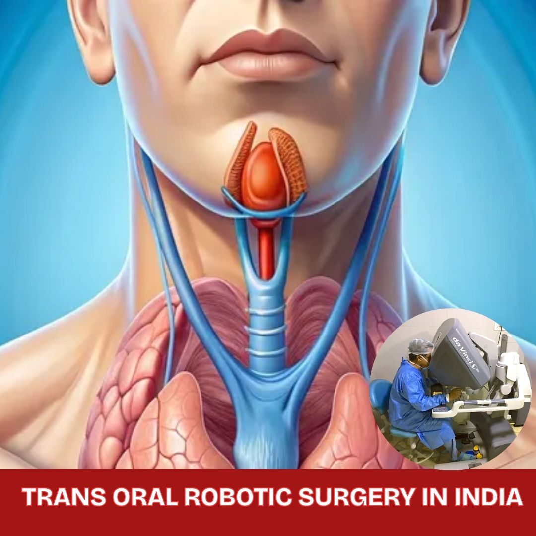Gurugram, Health, TORS Robotic Surgery Cost In India