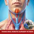 TORS Robotic Surgery Cost In India