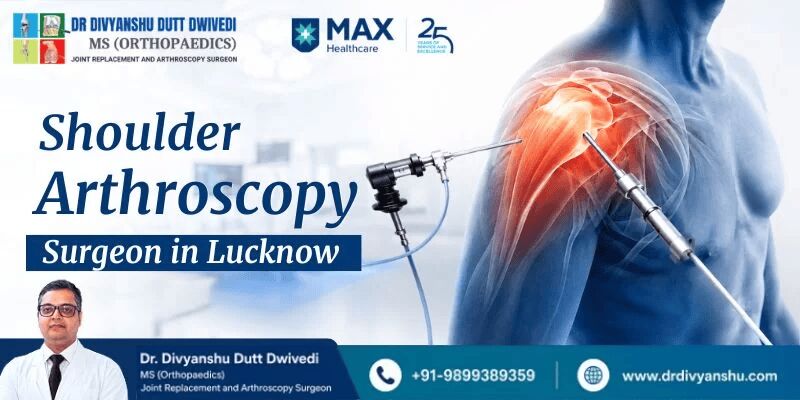 Lucknow, Medical, Arthroscopic Shoulder Surgeon In Lucknow | Dr. Divyanshu Dutt Dwivedi