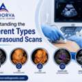 Understanding The Different Types Of Ultrasound Scans