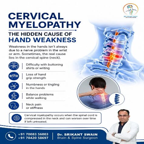 Bhubaneswar, Health, Cervical Myelopathy & Hand Weakness | Neurosurgeon In Bhubaneswar | Dr. Srikant Swain