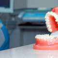Braces In Artesia, CA - Art Family Dental