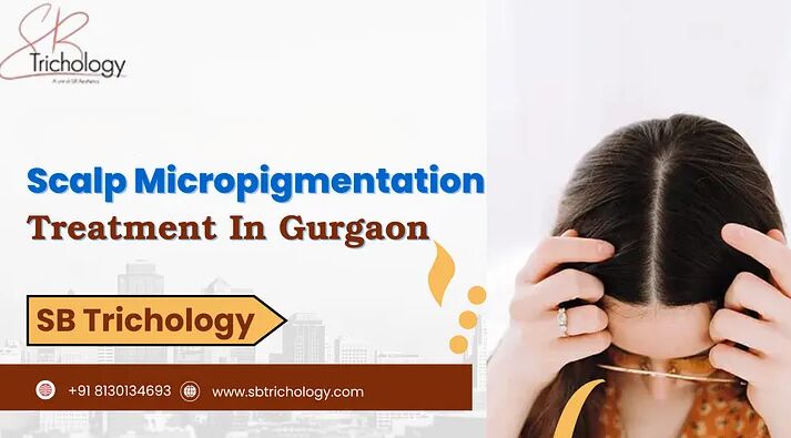 Gurgaon, Medical, Best Clinic For Scalp Micropigmentation In Gurgaon - SB Trichology