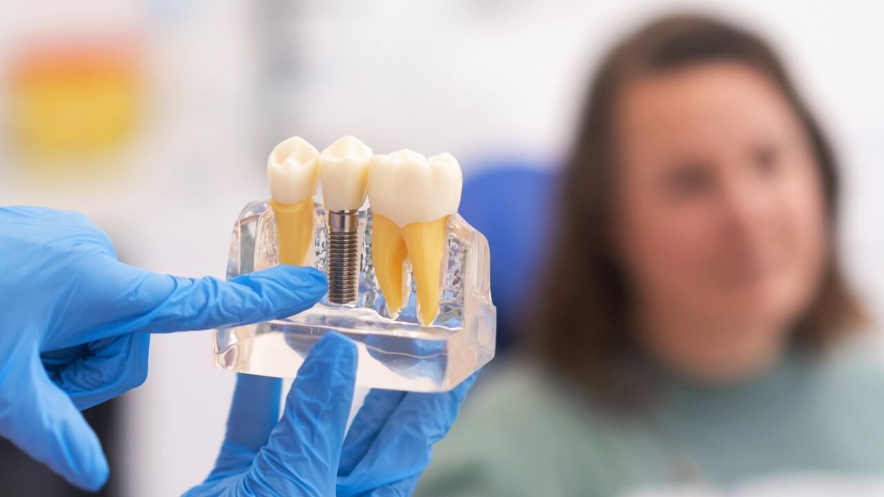 London, Dental, Dental Implant Treatment Abroad | Italy Dental Tourism | Meditouring
