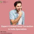 Expert Crooked Nose Correction In India Specialists