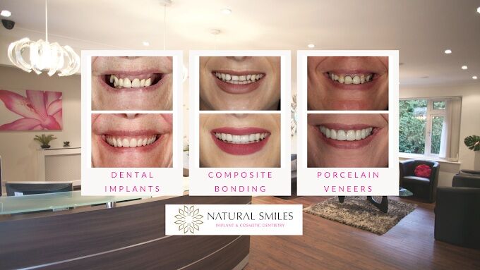 London, Dental, Natural Smiles Corby