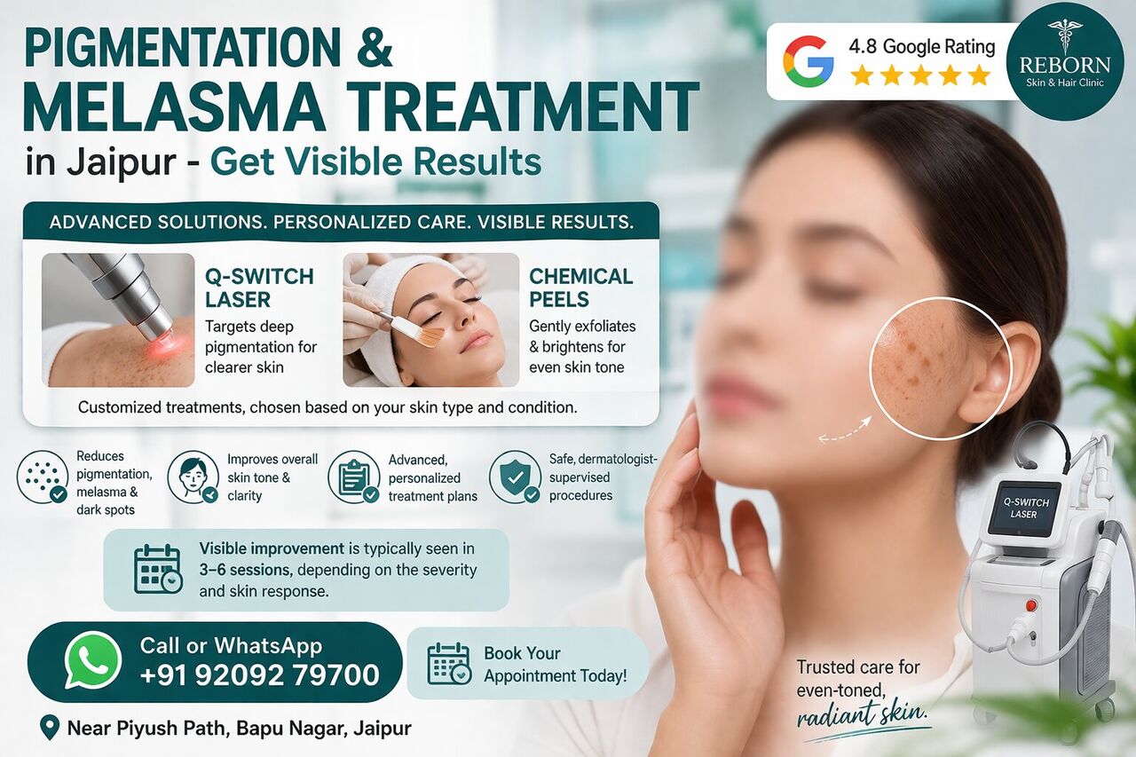 Jaipur, Health & Beauty Items, INR 4000,  Melasma Treatment In Jaipur For Persistent Facial Pigmentation
