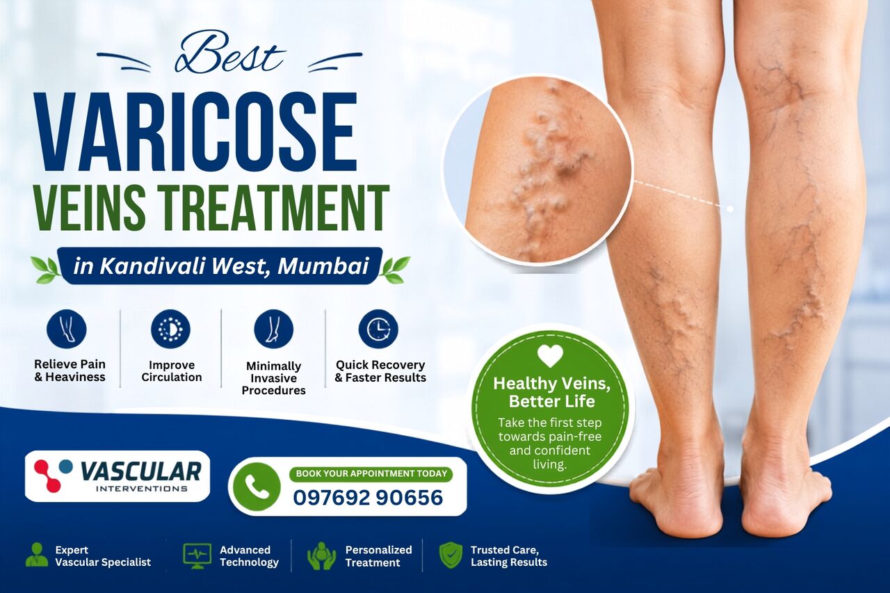 Mumbai, Health, Restore Healthy Legs With Advanced Vein Care