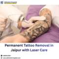 Permanent Tattoo Removal In Jaipur With Laser Care
