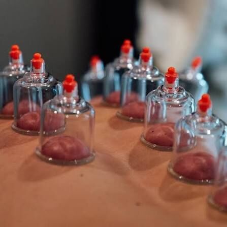 Gurgaon, Businesses For Sale, Best Cupping Therapy Services In Gurgaon | Pain Relief & Recovery