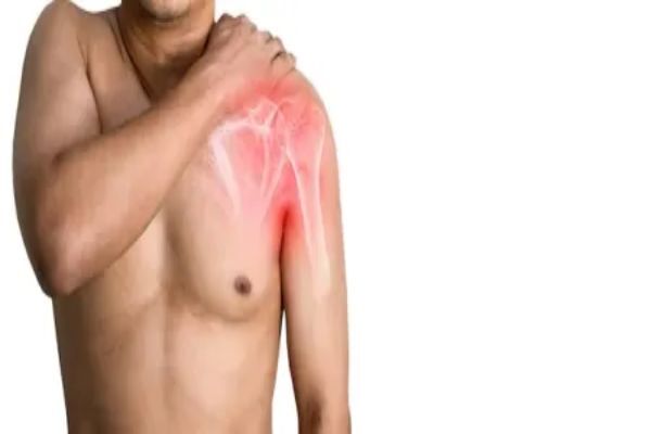 New York, Medical, Rotator Cuff Injury Specialist In New York &mdash; Dr. Christopher Ahmad