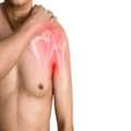 Rotator Cuff Injury Specialist In New York &mdash; Dr. Christopher Ahmad
